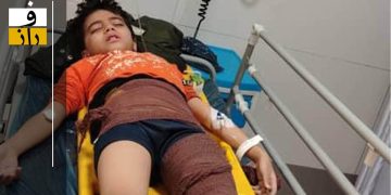 ضرب‌وشتم وحشیانه یک دانش‌آموز کلاس چهارمی توسط ناظم/ استخوان ران کودک خرد شده است! +عکس و ویدئو