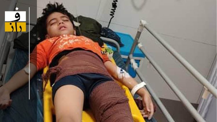 ضرب‌وشتم وحشیانه یک دانش‌آموز کلاس چهارمی توسط ناظم/ استخوان ران کودک خرد شده است! +عکس و ویدئو