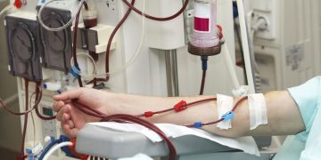 هزار بیمار در بیمارستان منتصریه مشهد هر ماه دیالیز می‌شوند