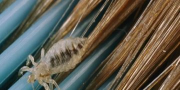 معاون آموزش و پرورش خراسان رضوی: مراقبان سلامت، خط مقدم کنترل شیوع «شپش» در مدارس هستند