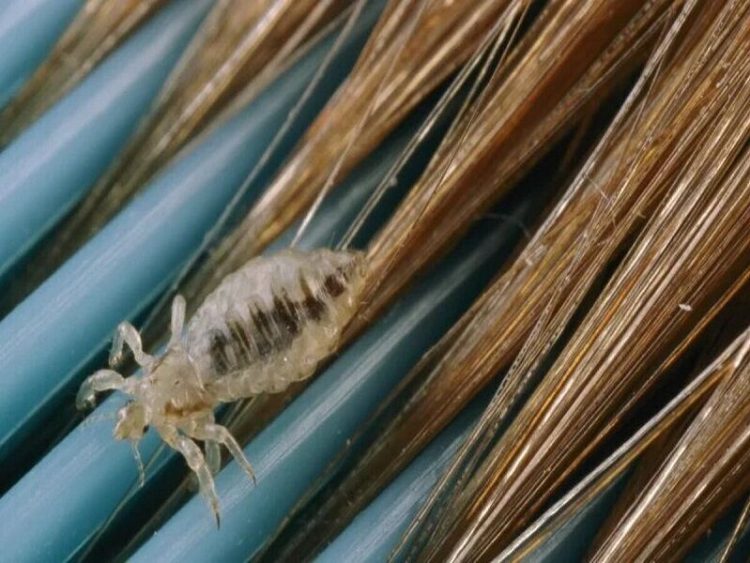 معاون آموزش و پرورش خراسان رضوی: مراقبان سلامت، خط مقدم کنترل شیوع «شپش» در مدارس هستند